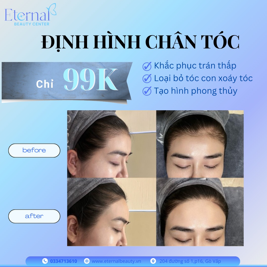 Vì sao nên định hình chân tóc?