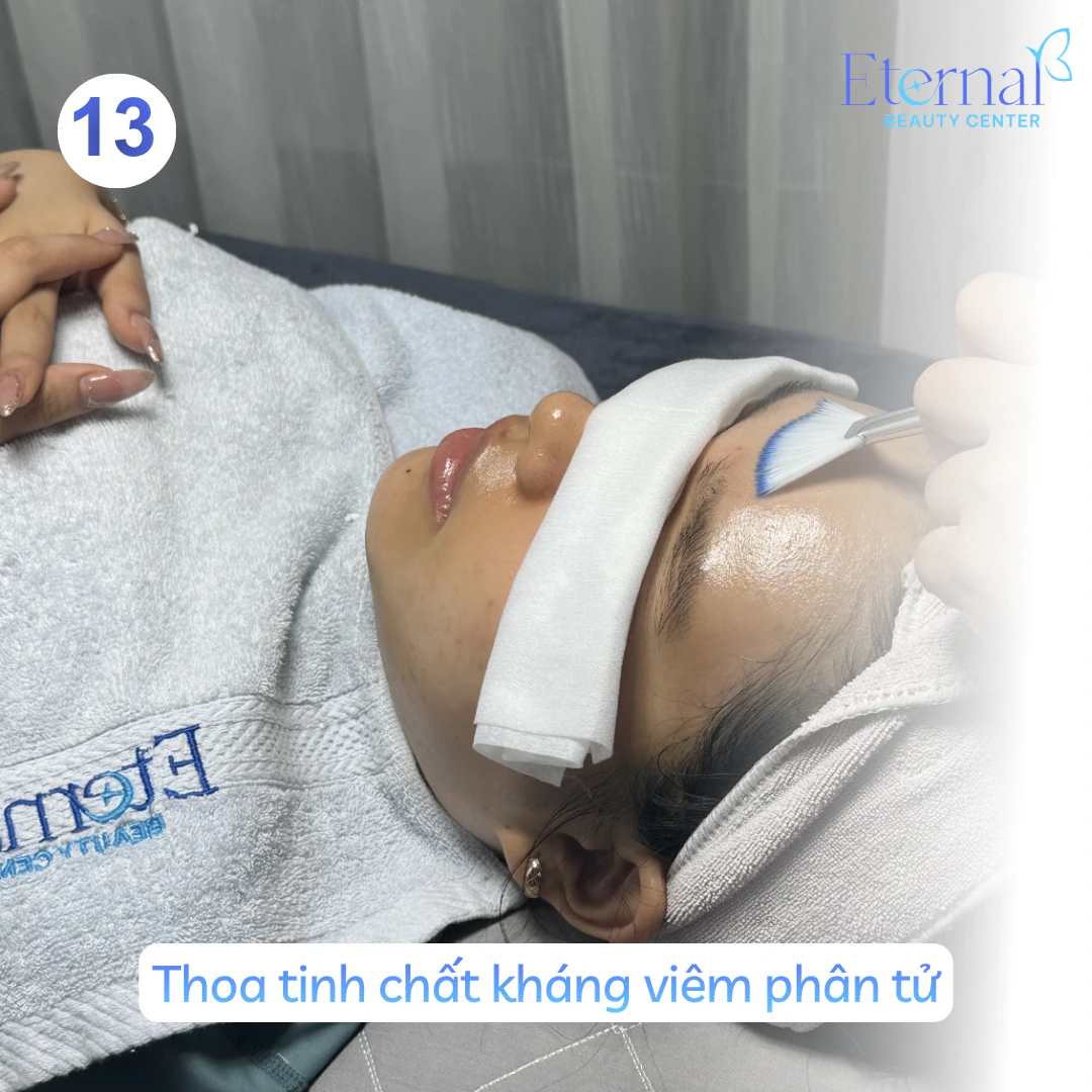 Bước 13 – Tinh chất kháng viêm trong quy trình xử lý nhân mụn chuẩn y khoa tại Eternal