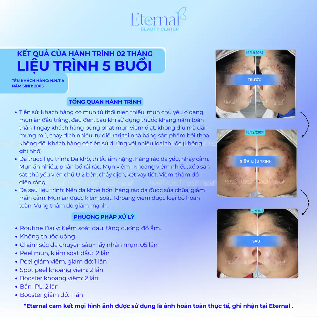 Tình trạng bệnh nhân sau 5 buổi điều trị