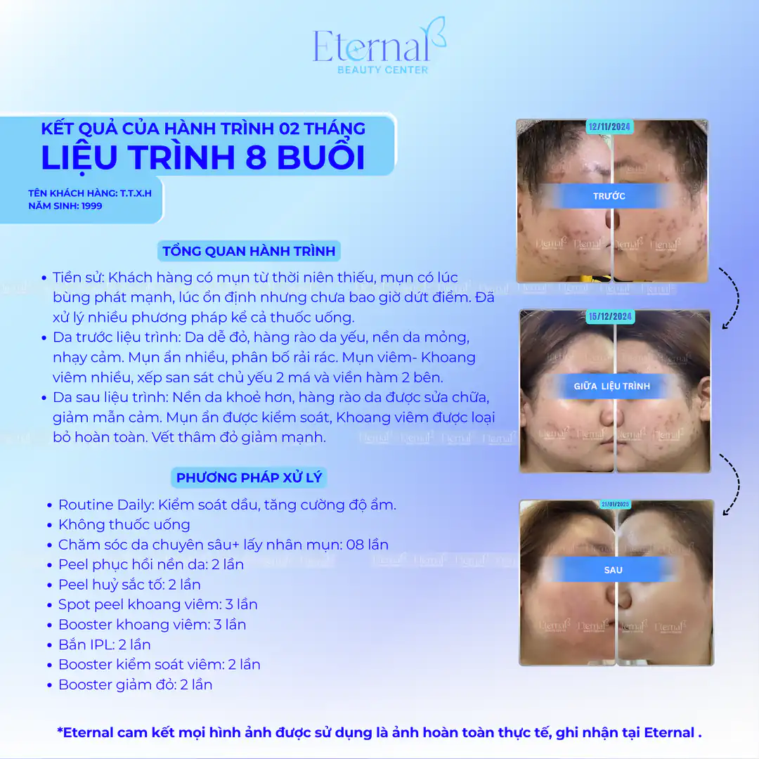 Tình trạng bệnh nhân sau 8 buổi điều trị
