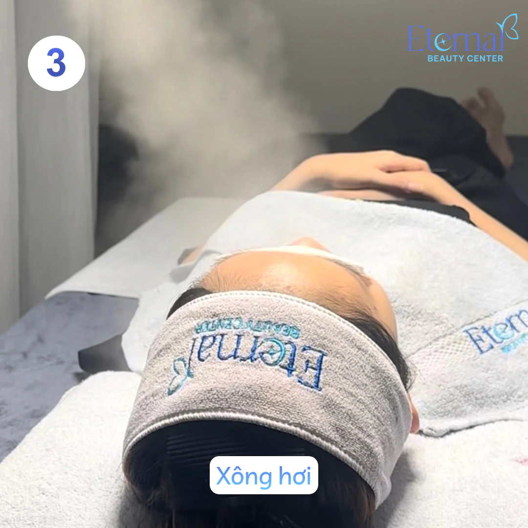 Bước 3 – Xông hơi trong quy trình xử lý nhân mụn chuẩn y khoa tại Eternal