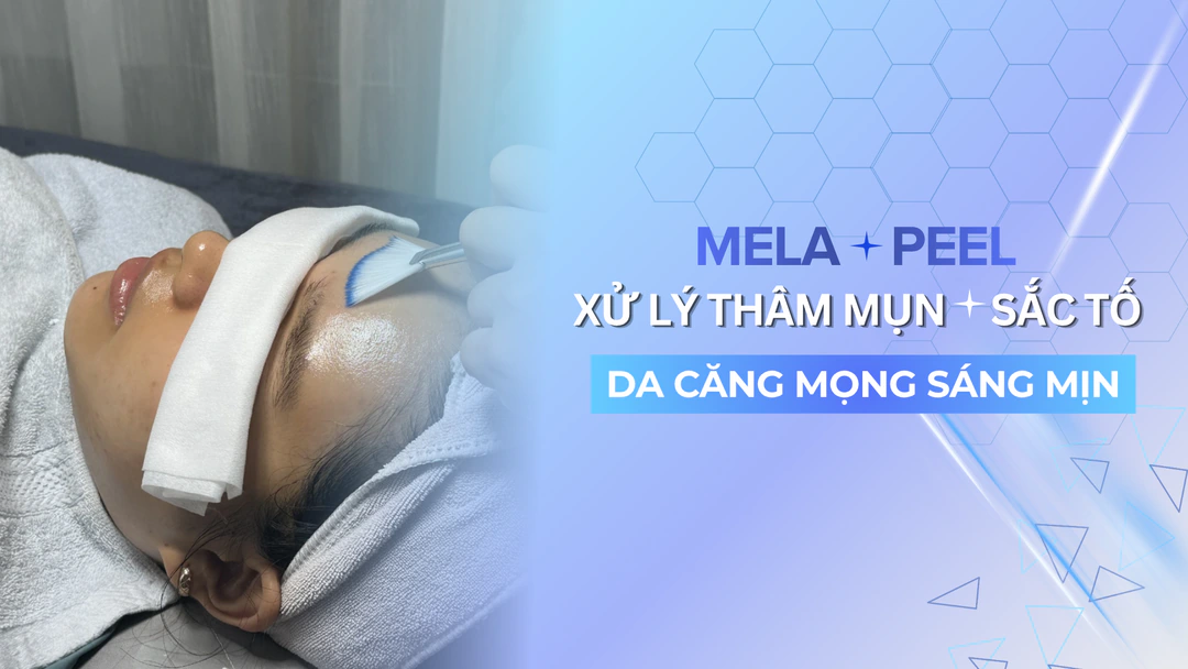 Mela Peel – Post-Acne Pigmentation Peel