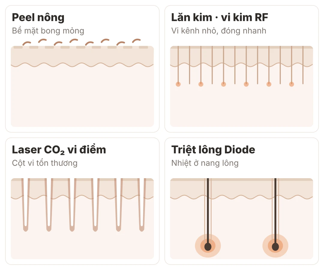 Sơ đồ bốn kiểu tổn thương: peel nông làm bong lớp bề mặt, lăn kim và vi kim RF tạo vi kênh nhỏ đóng nhanh, laser CO₂ vi điểm tạo các cột vi tổn thương xuống trung bì, triệt lông Diode dồn nhiệt vào nang lông và giữ nguyên lớp da ngoài