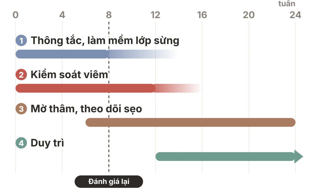 Biểu đồ bốn giai đoạn điều trị mụn lưng theo tuần: thông tắc và kiểm soát viêm bắt đầu cùng lúc từ tuần đầu, mờ thâm và theo dõi sẹo khi viêm đã lắng, duy trì sau khi lưng sạch, mốc đánh giá lại ở khoảng tuần 8