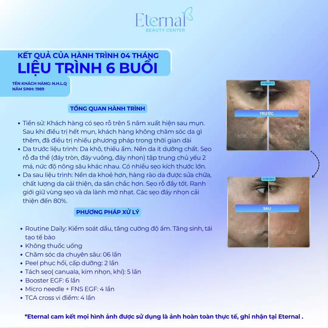 Tình trạng bệnh nhân sau 6 buổi điều trị
