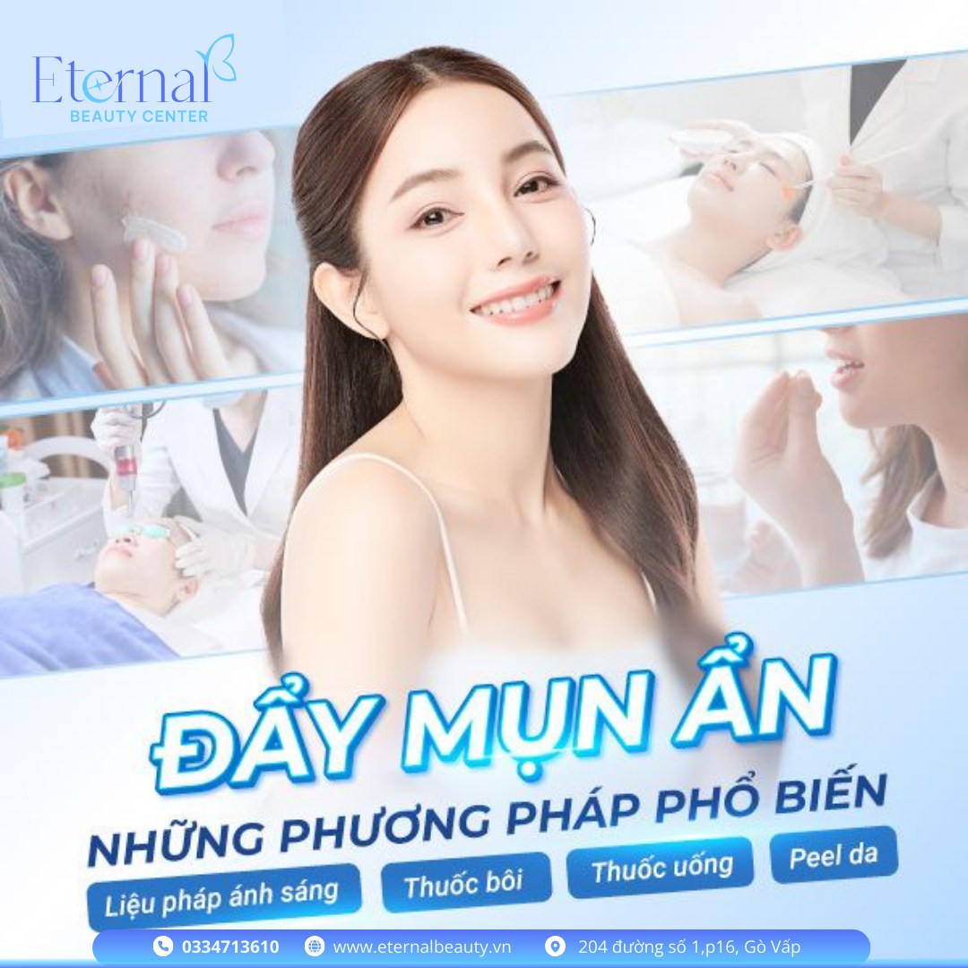 Đẩy Mụn Ẩn – Những Phương Pháp Phổ Biến Và Hiệu Quả Hiện Nay