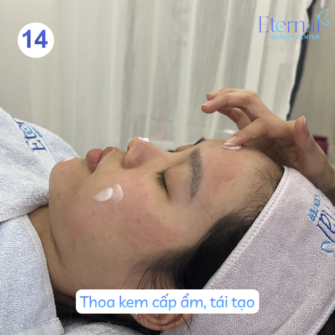 Bước 14 – Cấp ẩm, phục hồi trong quy trình xử lý nhân mụn chuẩn y khoa tại Eternal
