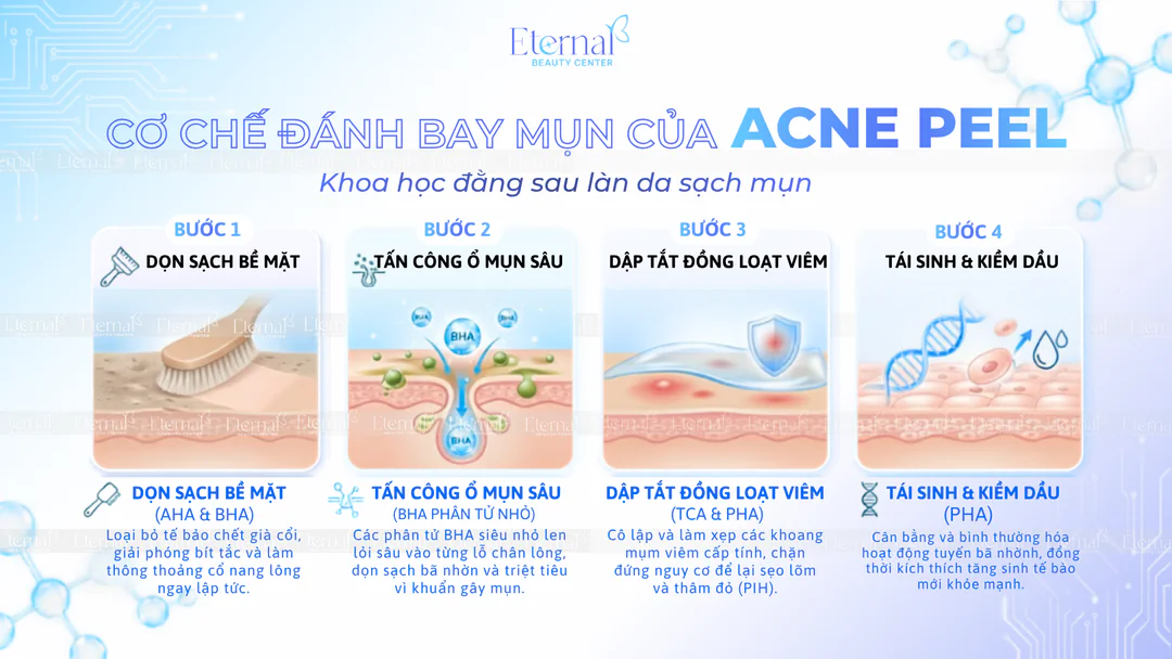 Sơ đồ cơ chế peel da trên da mụn: làm sạch bề mặt, hoạt chất thấm vào nang lông, giảm viêm và tái tạo da