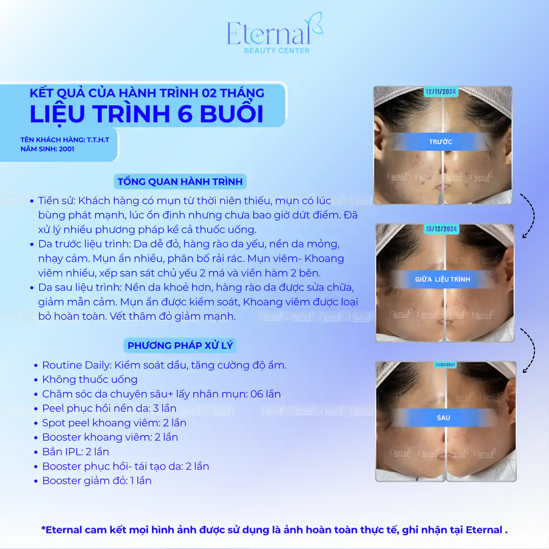 Tình trạng HT sau 6 buổi