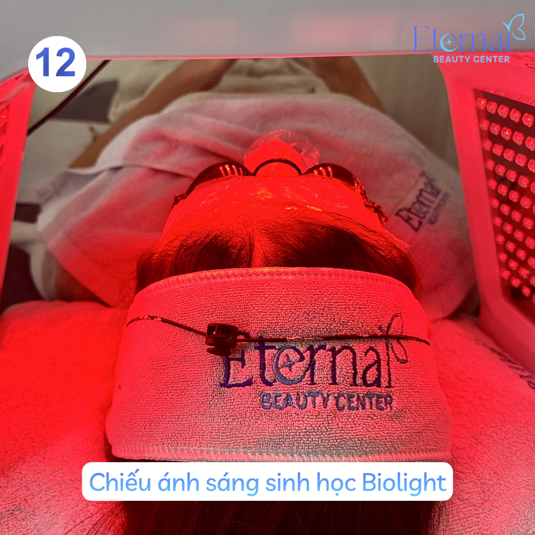 Bước 12 – Chiếu Biolight trong quy trình xử lý nhân mụn chuẩn y khoa tại Eternal