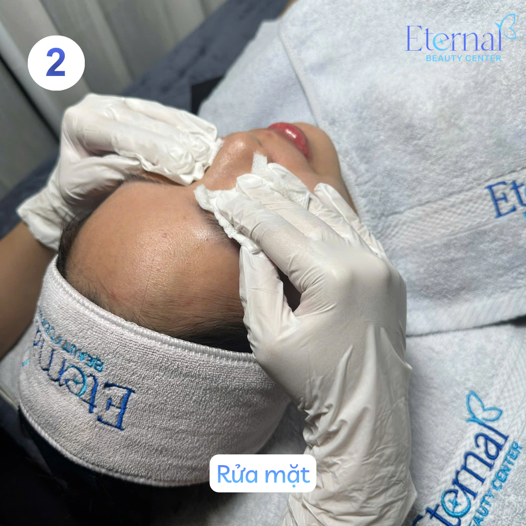 Bước 2 – Rửa mặt trong quy trình xử lý nhân mụn chuẩn y khoa tại Eternal