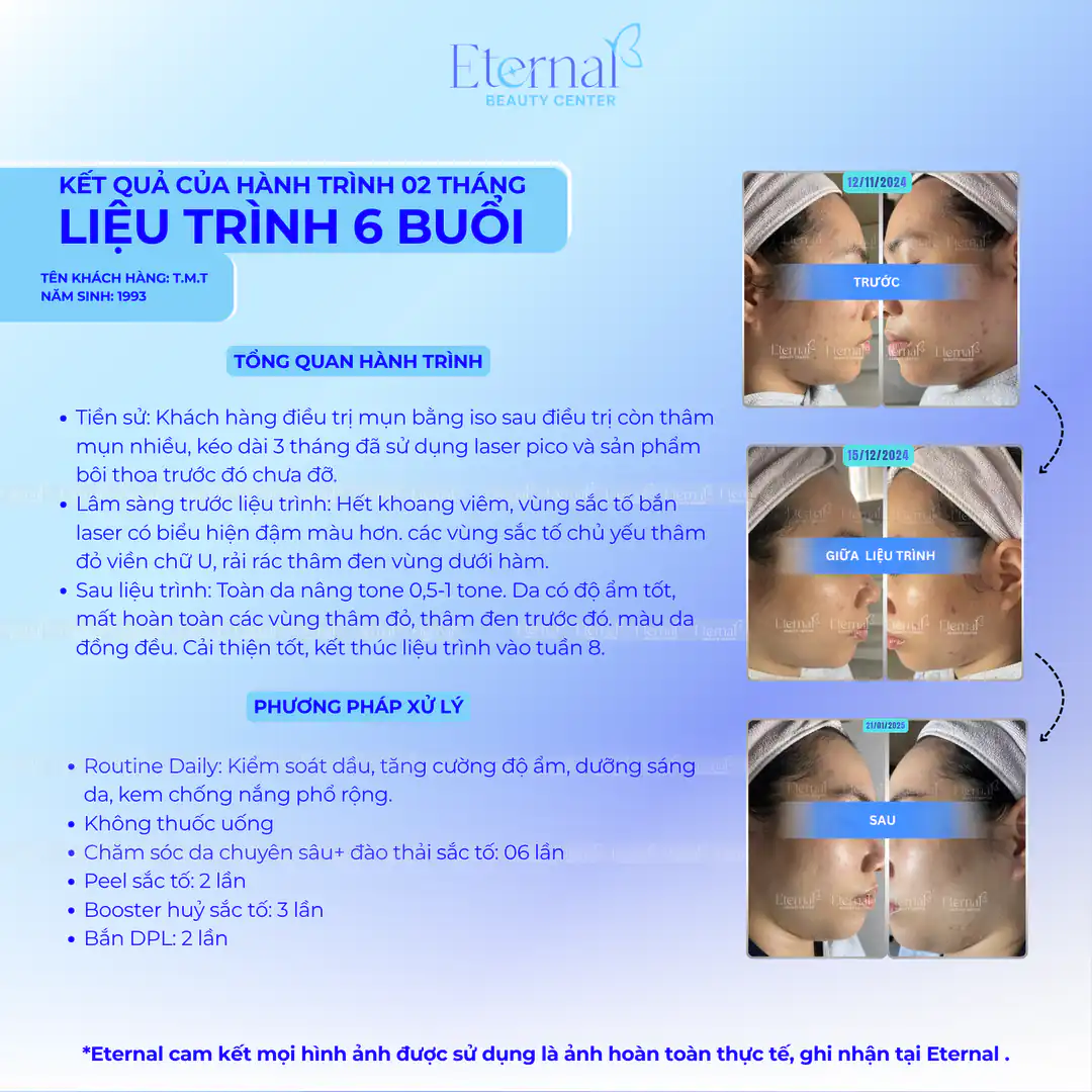 Tình trạng bệnh nhân sau 6 buổi điều trị