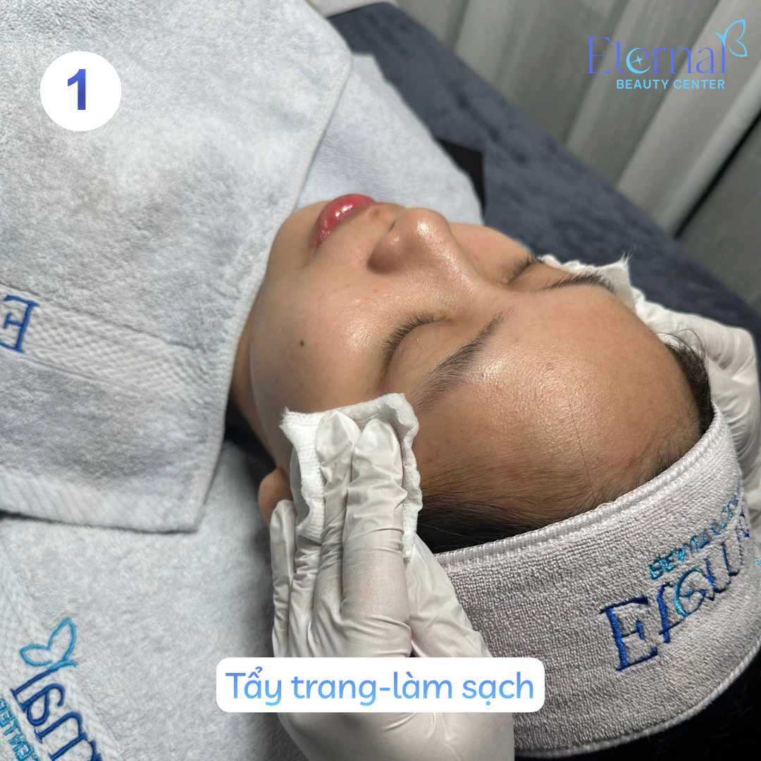 Bước 1 – Tẩy trang trong quy trình xử lý nhân mụn chuẩn y khoa tại Eternal