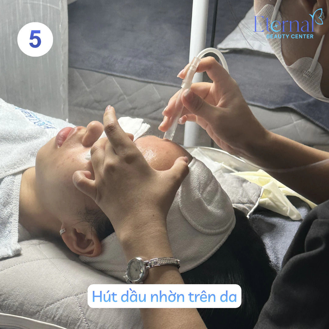 Bước 5 – Hút dầu nhờn trong quy trình xử lý nhân mụn chuẩn y khoa tại Eternal