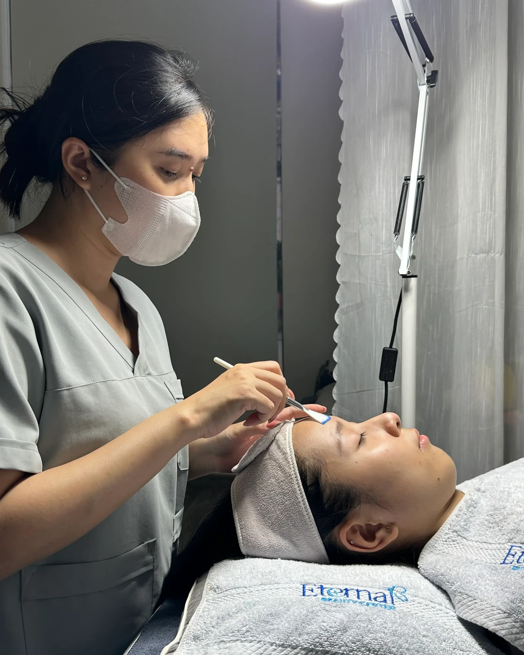 Bôi hoạt chất peel bằng cọ theo từng vùng trên trán — peel trị thâm được bôi phân vùng, vùng thâm đậm và vùng thâm nhẹ được xử lý khác nhau