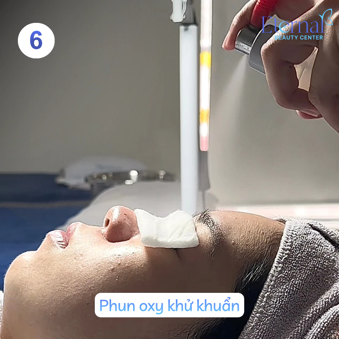Bước 6 – Phun Oxy tươi trong quy trình xử lý nhân mụn chuẩn y khoa tại Eternal