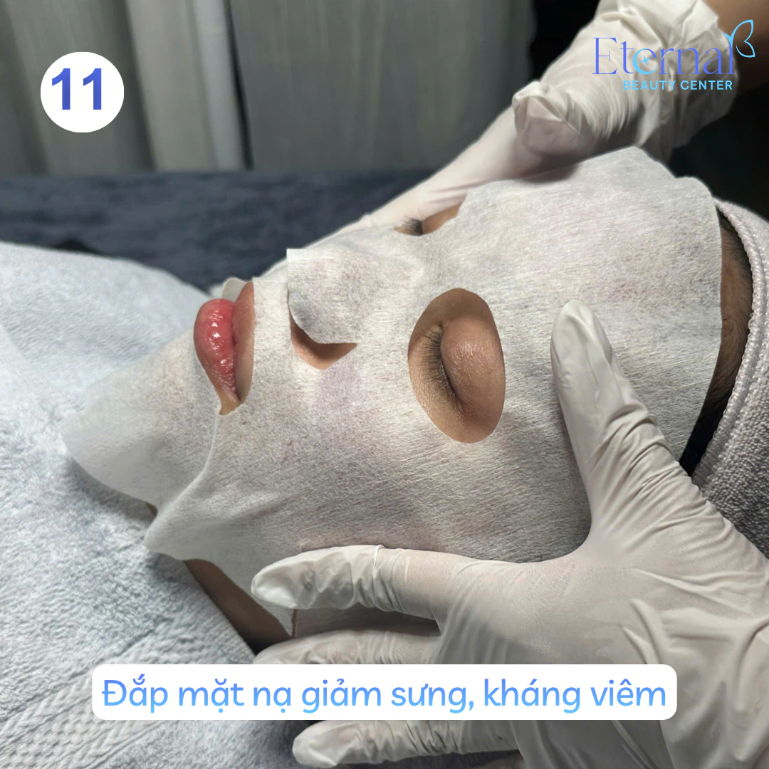 Bước 11 – Đắp mặt nạ trong quy trình xử lý nhân mụn chuẩn y khoa tại Eternal