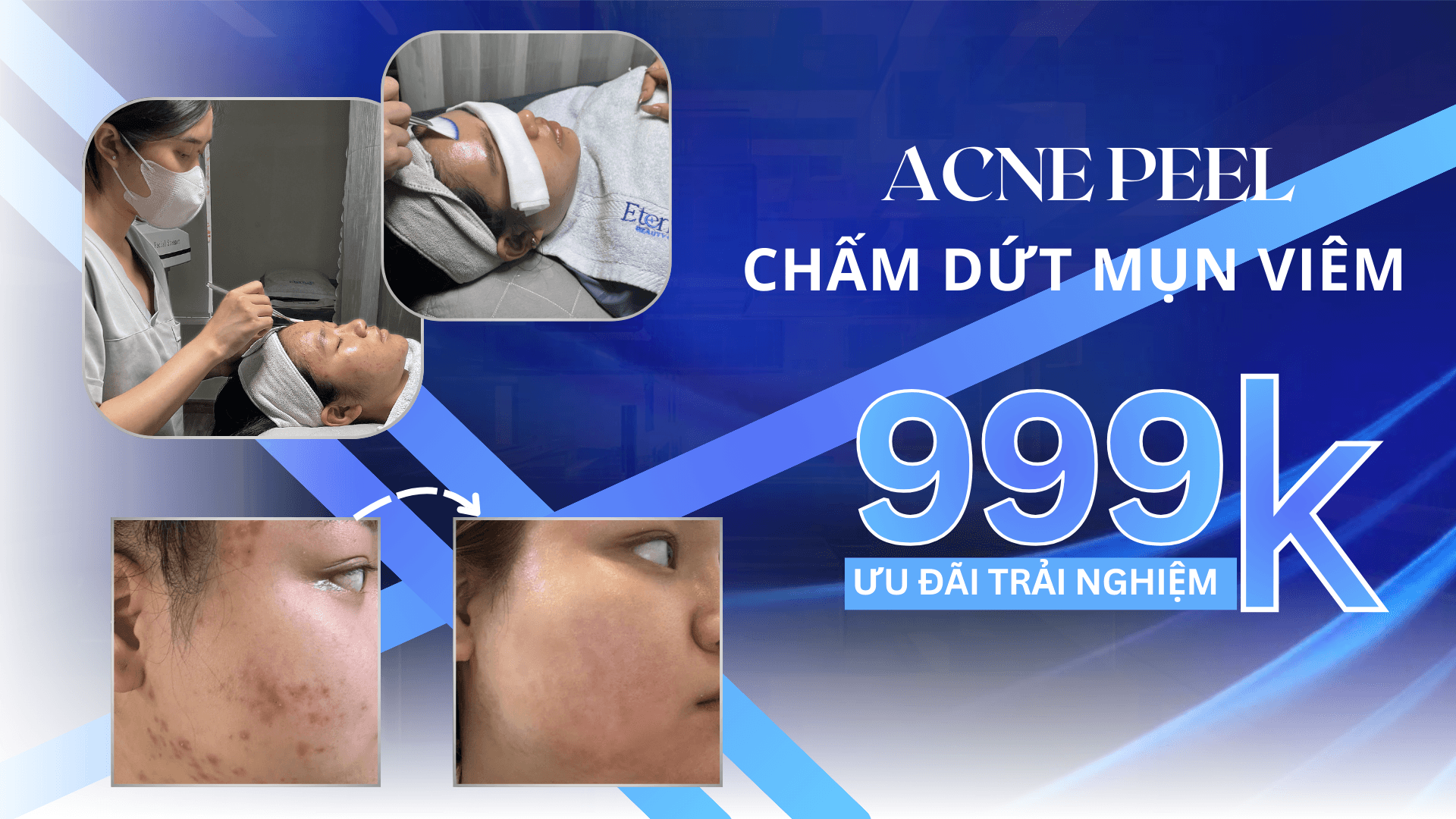 Eternal Beauty Center - Ưu đãi tết 2026